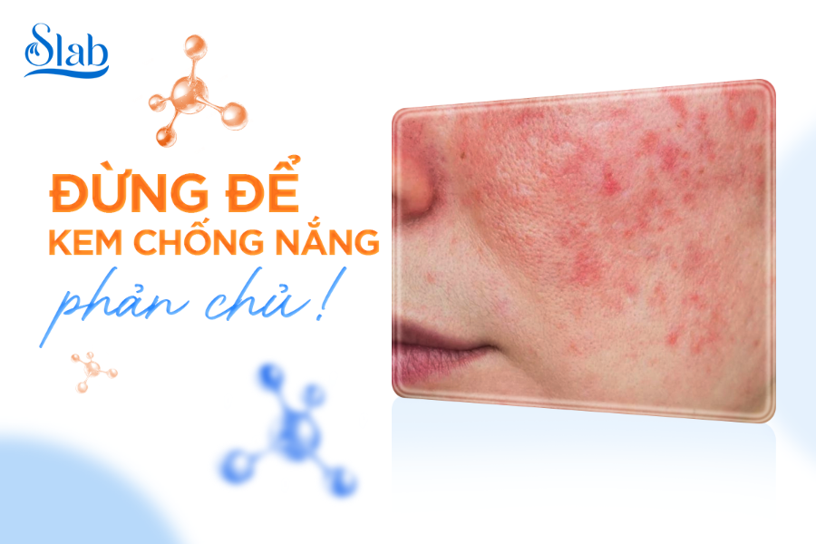 Chống nắng đúng cách: Đừng để kem chống nắng phản chủ!